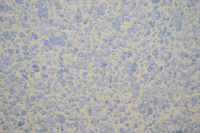 Жидкие обои SILK PLASTER Рельеф Г-326 